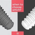 Ceramic Versus Titanium Dental Implants