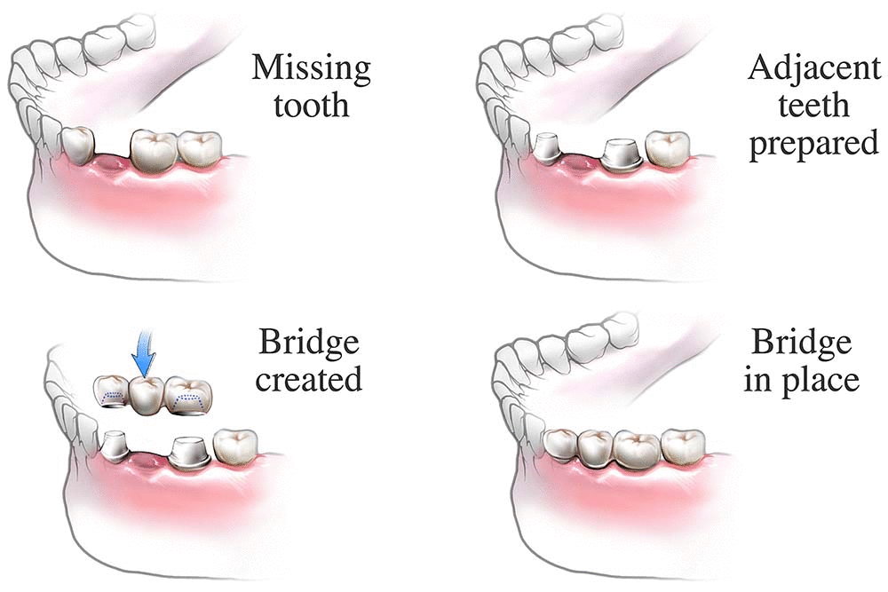 Proper Care and Maintenance